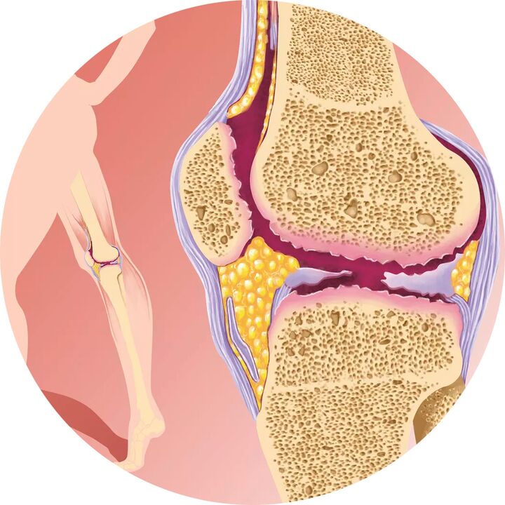 Hondroten - Wspomaga mobilność stawów