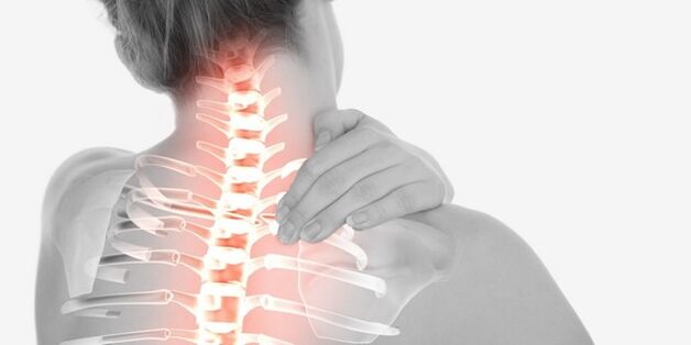 ból szyi z powodu osteochondrozy